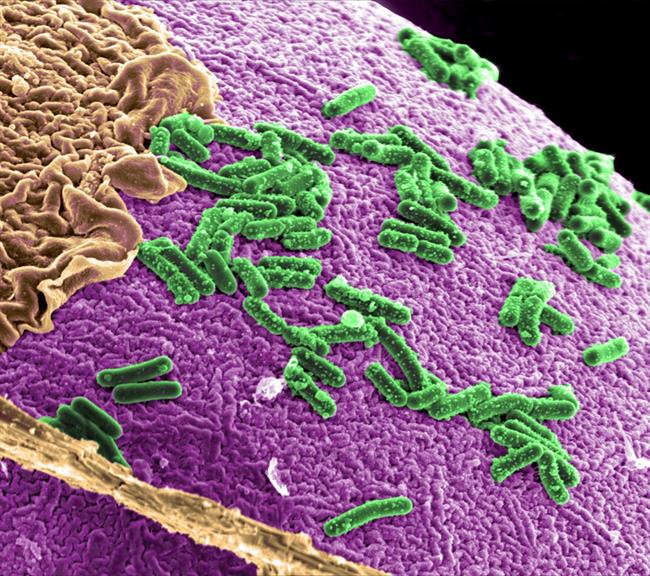 Microbiota intestinal | EUROPA PRESS/UNIVERSIDAD PABLO DE OLAVIDE ep microbiota intestinal