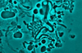 ep una bacteria ecoli qeue ha cambiado a una forma en l es decir sin pared celular para evitar a los