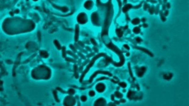 ep una bacteria ecoli qeue ha cambiado a una forma en l es decir sin pared celular para evitar a los