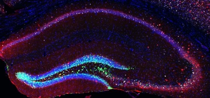 ep celulas madre y neuronas generadas artificialmente en el cerebro de ratones