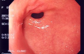 ep imagenuna endoscopia