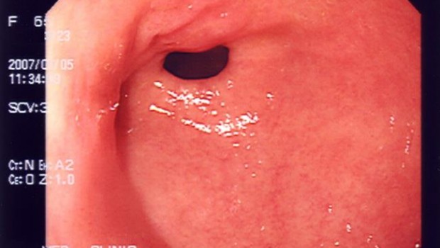 ep imagenuna endoscopia