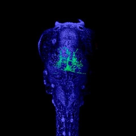 ep la imagen muestra un embrion de pez cebra con celulas cancerosas verde en su sistema nervioso los