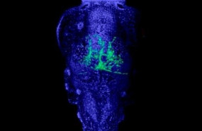 ep la imagen muestra un embrion de pez cebra con celulas cancerosas verde en su sistema nervioso los