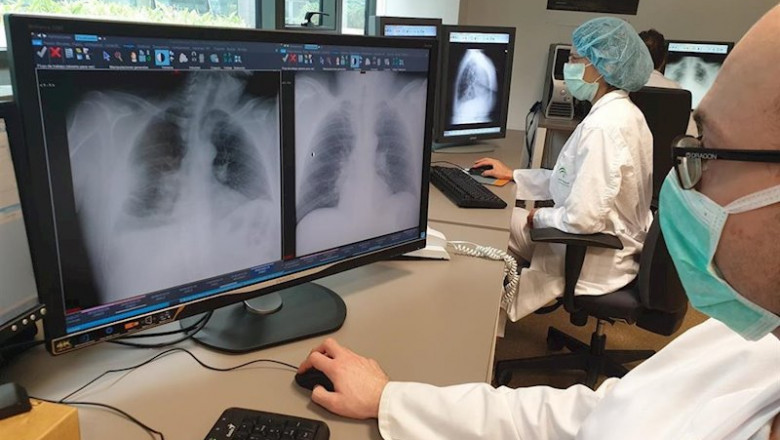 ep sanitarios realizan radiografias para diagnosticar si un paciente tiene coronavirus