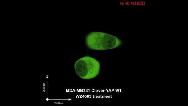 Una proteína bloque el 'círculo vicioso' del cáncer | ATTISANO LAB, DONNELLY CENTRE, UNIVERSITY OF TORON ep una proteina bloque el circulo vicioso del cancer