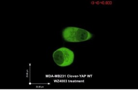 ep una proteina bloque el circulo vicioso del cancer