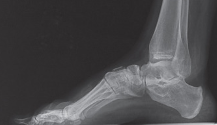 1576747494 captura de pantalla 2019 12 19 a les 102308