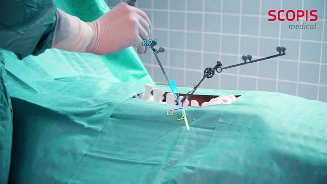 ep scopis surgical navigation