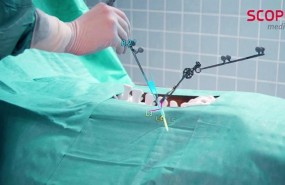 ep scopis surgical navigation