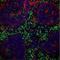 ep micrografiaun bazoqueencuentran abundantes neutrofilos en verde