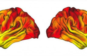 ep cerebro