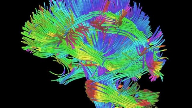 ep cerebro