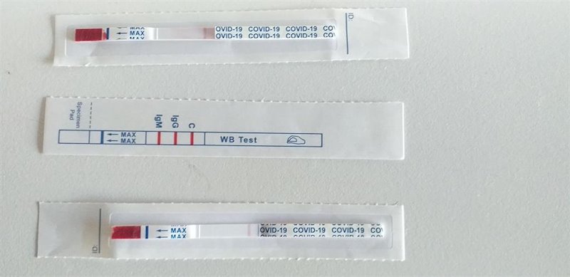 Test de Covid-19 | EUROPA PRESS ep test de covid-19