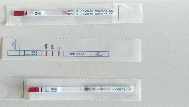 ep test de covid-19