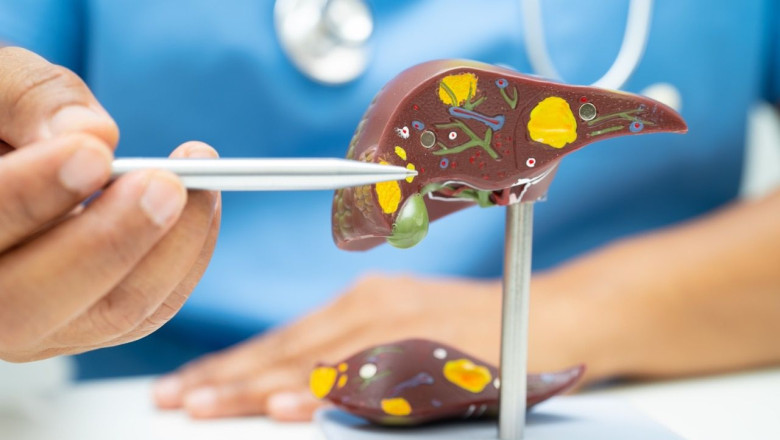 higado graso en tamano grande