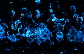 ep esta imagen muestrapatologia anormalalfa-sinucleinalewy agregadadeneuronashipocampocerebroun modeloratonla enfermedadparkinsondemenciacuerposlewy