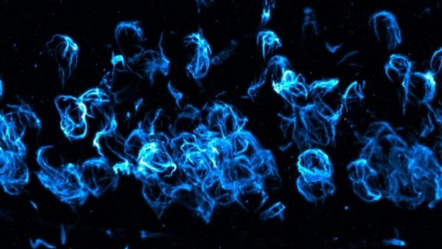 ep esta imagen muestrapatologia anormalalfa-sinucleinalewy agregadadeneuronashipocampocerebroun modeloratonla enfermedadparkinsondemenciacuerposlewy