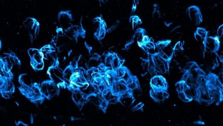 Esta imagen muestra la patología anormal de alfa-sinucleína de Lewy agregada dentro de las neuronas del hipocampo del cerebro en un modelo de ratón de la enfermedad de Parkinson y demencia con cuerpos de Lewy | OREGON HEALTH & SCIENCE UNIVERSITY ep esta imagen muestrapatologia anormalalfa-sinucleinalewy agregadadeneuronashipocampocerebroun modeloratonla enfermedadparkinsondemenciacuerposlewy
