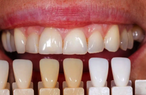 foto el 40 se acompleja de su sonrisa 