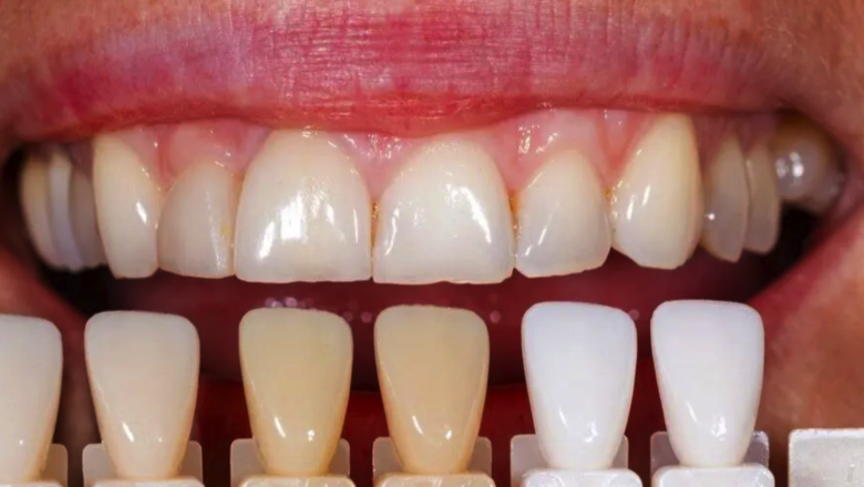 foto el 40 se acompleja de su sonrisa 