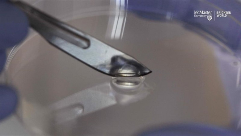 Los ingenieros de McMaster que se especializan en enfermedades infecciosas han creado un gel que destruye las bacterias y está compuesto completamente de virus amigables. El gel puede curarse solo cuando se corta. | JD HOWELL, UNIVERSIDAD MCMASTER ep los ingenierosmcmasterse especializanenfermedades infecciosascreadogeldestruyebacteriasesta compuesto completamentevirus amigables gelcurarsecuandocorta