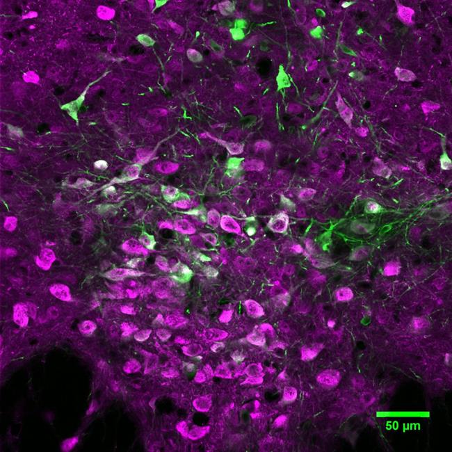 ep microfotografianeuronas productorasserotoninacerebroratones