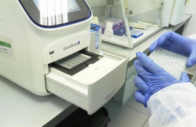ep proyecto pionero detectara el rastro del coronavirus en aguas residuales de valncia ep proyecto pionero detectara el rastro del coronavirus en aguas residuales de valncia