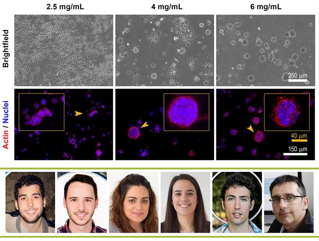 El grupo M2BE del I3A que invetiga sobre el cáncer y la metástasis | UZ ep grupo m2bei3ainvetigacancerla metastasis