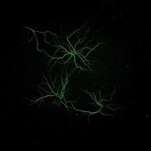 ep identifican dos moleculas marinas con potencial terapeutico contra el alzheimer ep identifican dos moleculas marinas con potencial terapeutico contra el alzheimer