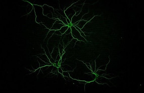 ep identifican dos moleculas marinas con potencial terapeutico contra el alzheimer
