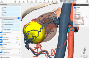 modelo 3d renal cella medical solutions 1