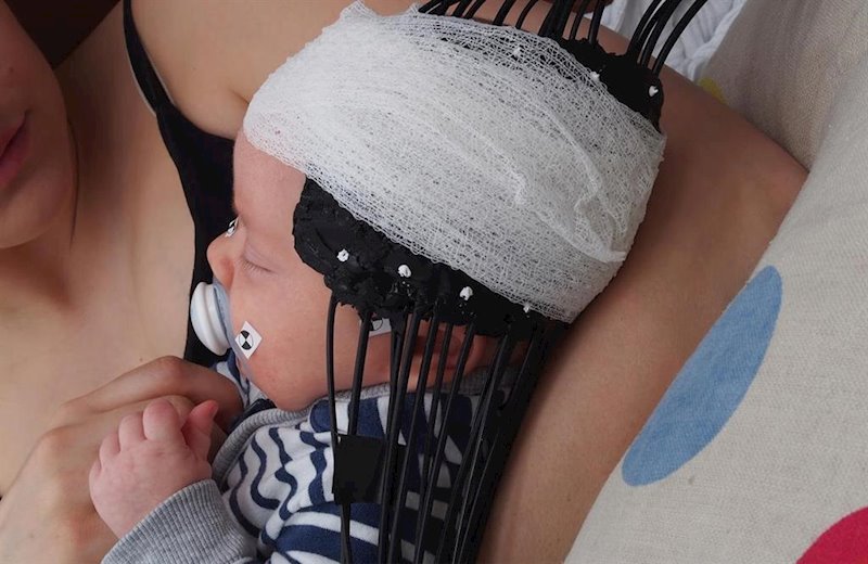 ep el equipo de escaneo cerebral utiliza fibra optica sujeta a la cabeza del bebe con una gasa
