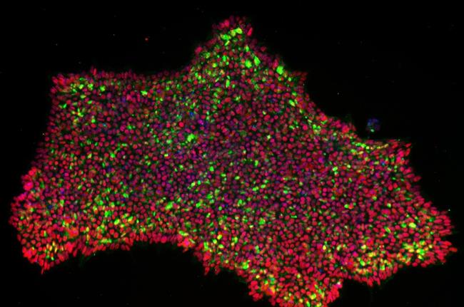 Las colonias de células madre pluripotentes inducidas reprogramadas CRISPRa se t | OTONKOSKI LAB / UNIVERSIDAD DE HELSINKI ep las coloniascelulas madre pluripotentes inducidas reprogramadas crisprat
