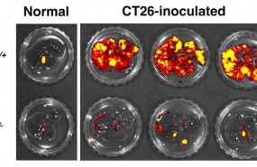 ep celulas de cancer colorrectal se reducen cuando se desactiva la proteina il-6