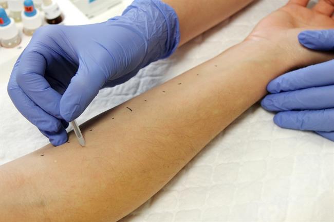 ep pruebas cutaneasalergia