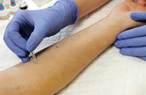 ep pruebas cutaneasalergia