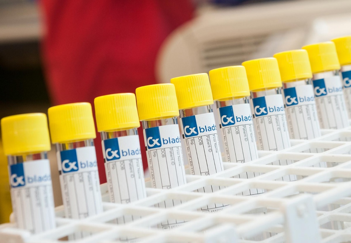 La neozelandesa Pacific Edge se desploma un 78% tras perder el respaldo del Medicare