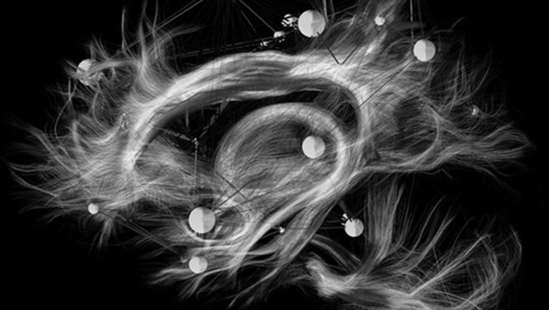 Un médico francés convierte en obras de arte las pruebas de resonancia magnética | GE HEALTHCARE ep un medico frances convierteobrasartepruebasresonancia magnetica
