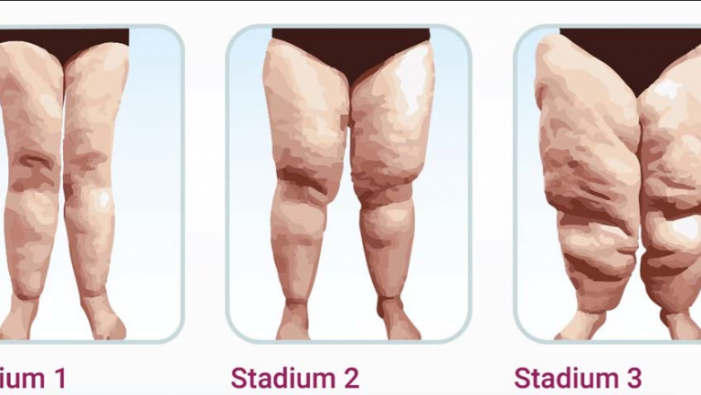 1582727447 cli nica bruselas