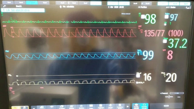 ep el respirador andalucia respira supera con exito el segundo ensayo en humanos