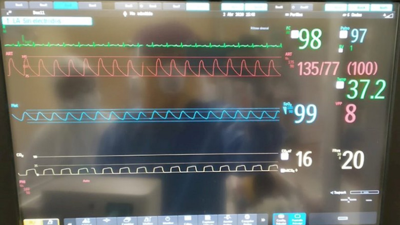 ep el respirador andalucia respira supera con exito el segundo ensayo en humanos