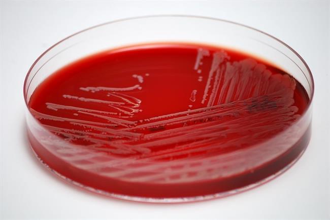 ep muestra de s aureus