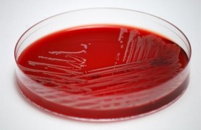 ep muestra de s aureus