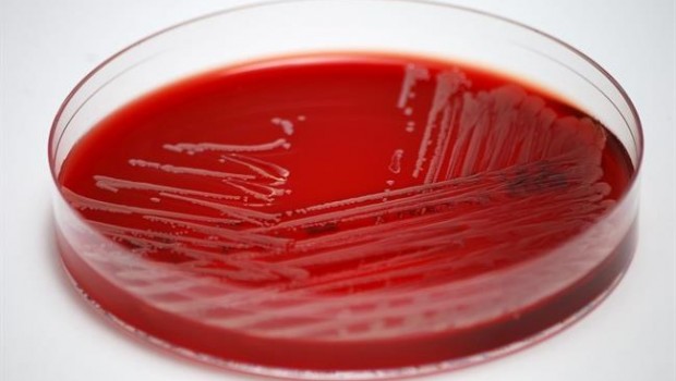 ep muestra de s aureus