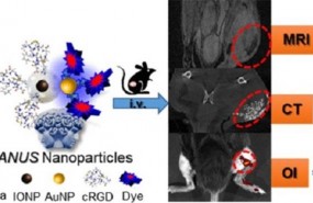 ep composicionaplicacionla nanoplataforma janusimagen medica multimoda