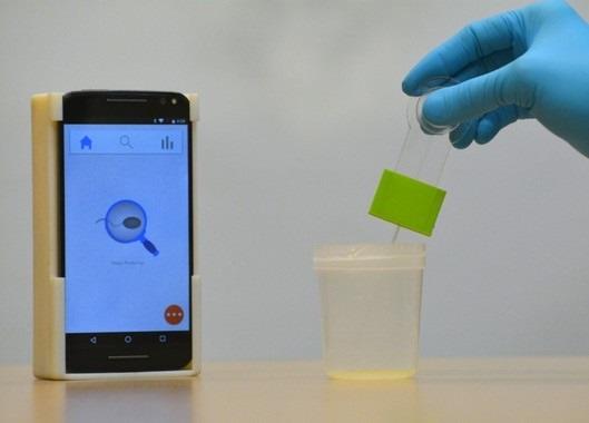 Nuevo dispositivo que mide la fertilidad del semen con el móvil | VIGNESH NATARAJAN ep nuevo dispositivomidefertilidadsemenmovil
