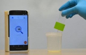 ep nuevo dispositivomidefertilidadsemenmovil
