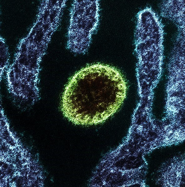 ep virus nipah