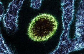 ep virus nipah